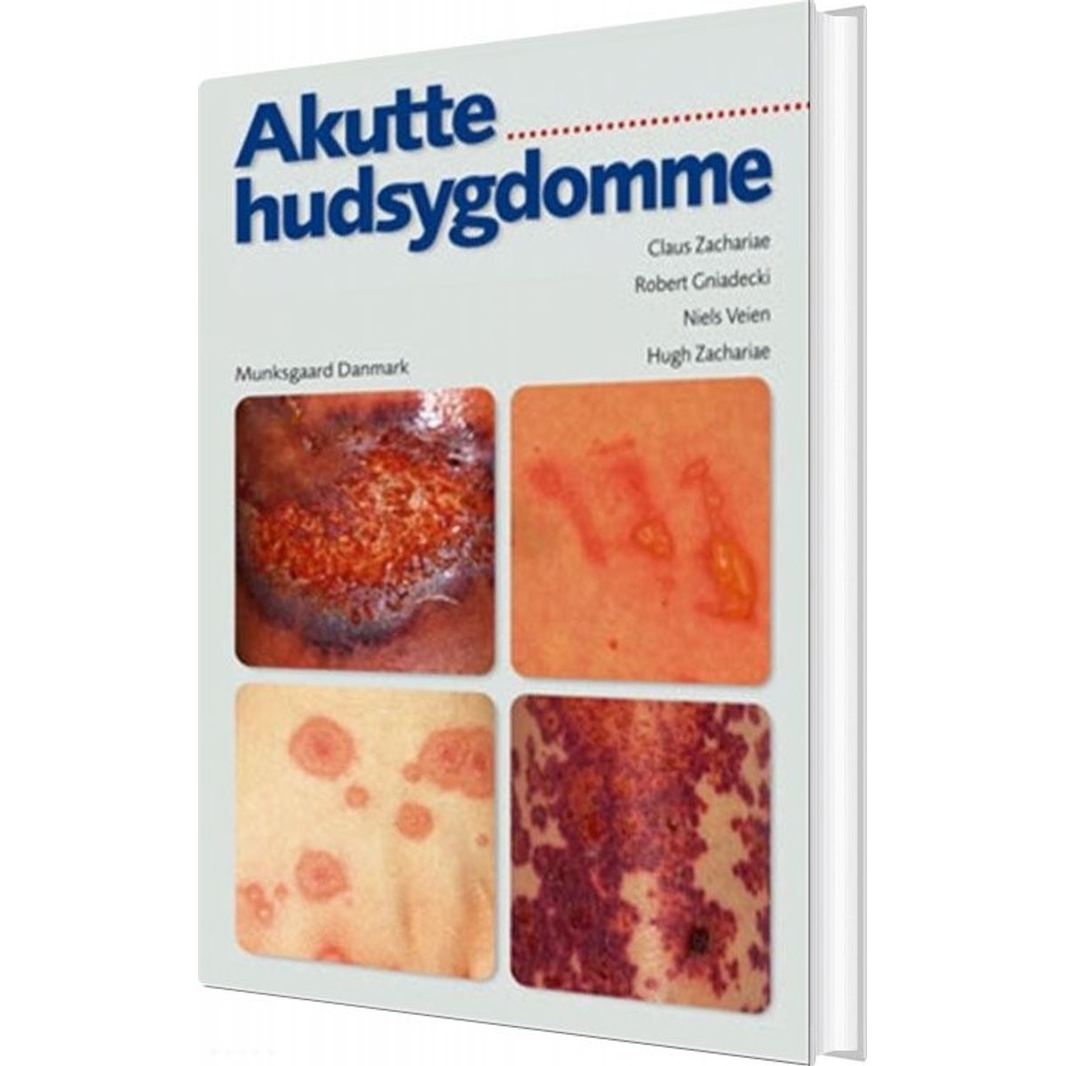 Akutte Hudsygdomme - Robert Gniadecki - Bog