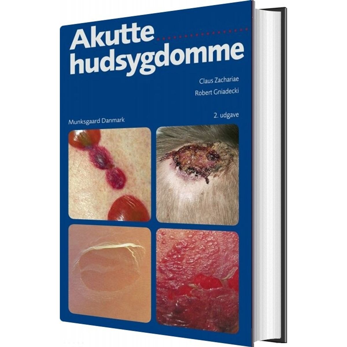 Akutte Hudsygdomme - Robert Gniadecki - Bog