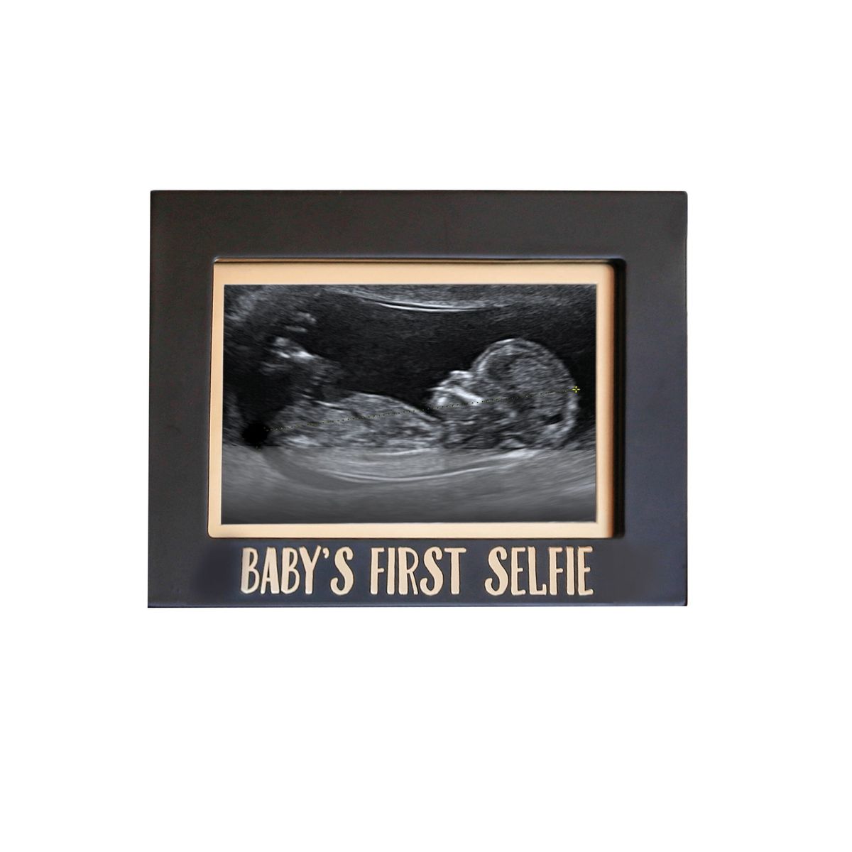 Baby's første selfie - Sonogram fotoramme