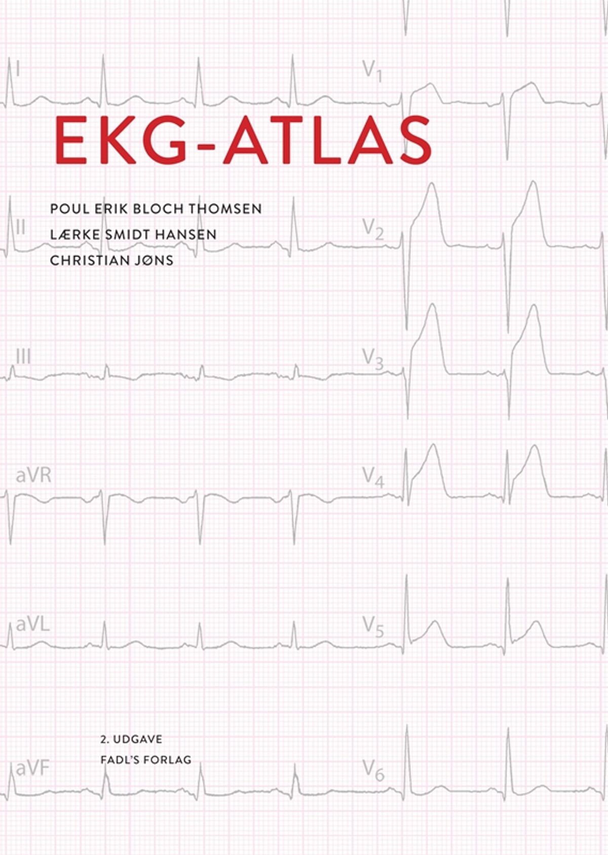 EKG-atlas