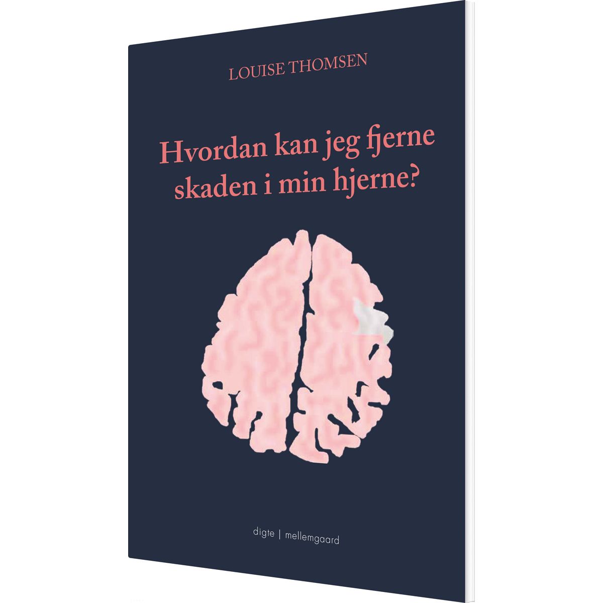 Hvordan Kan Jeg Fjerne Skaden I Min Hjerne? - Louise Thomsen - Bog