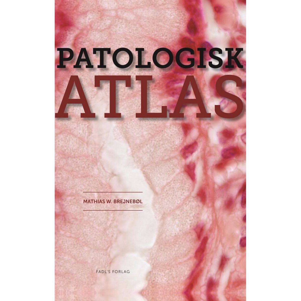 Patologisk Atlas - Mathias Willadsen Brejnebøl - Bog