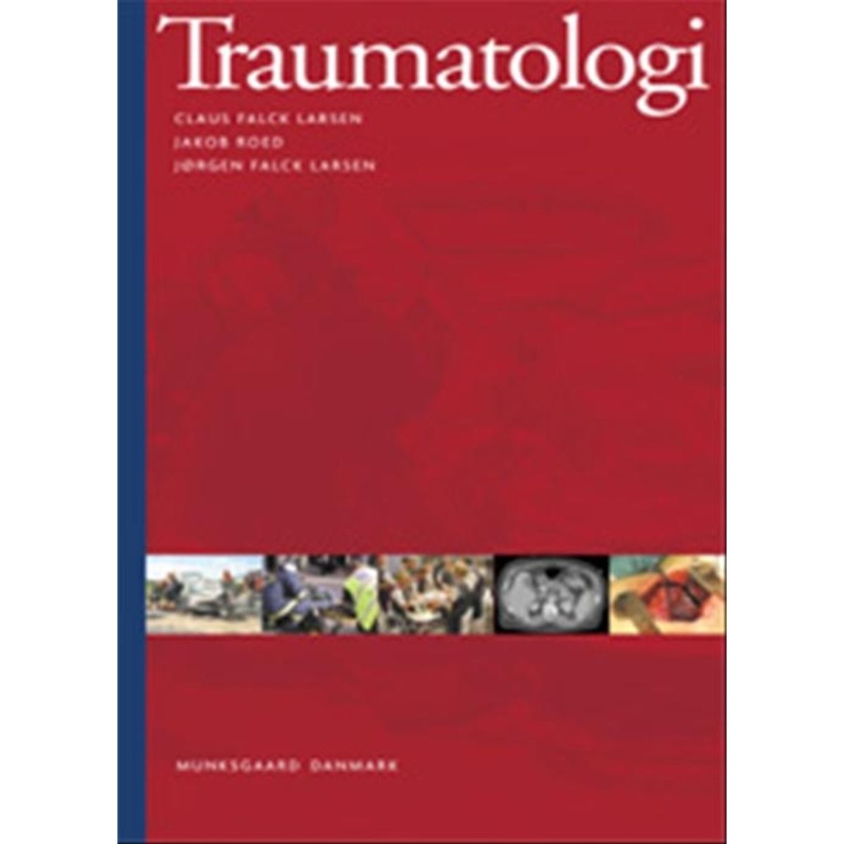 Traumatologi