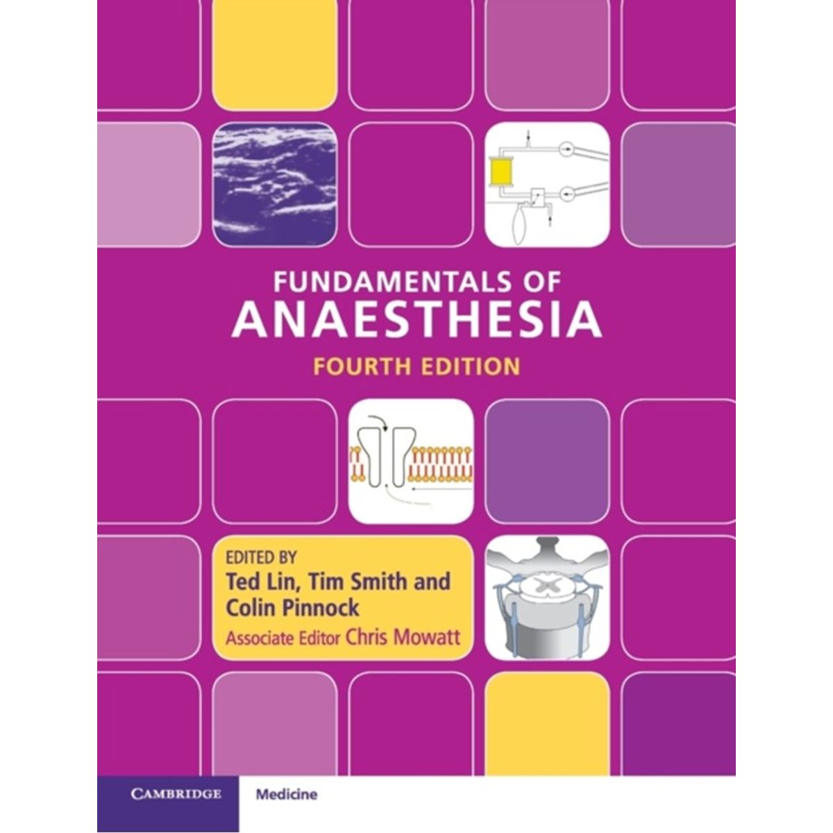 Fundamentals of Anaesthesia