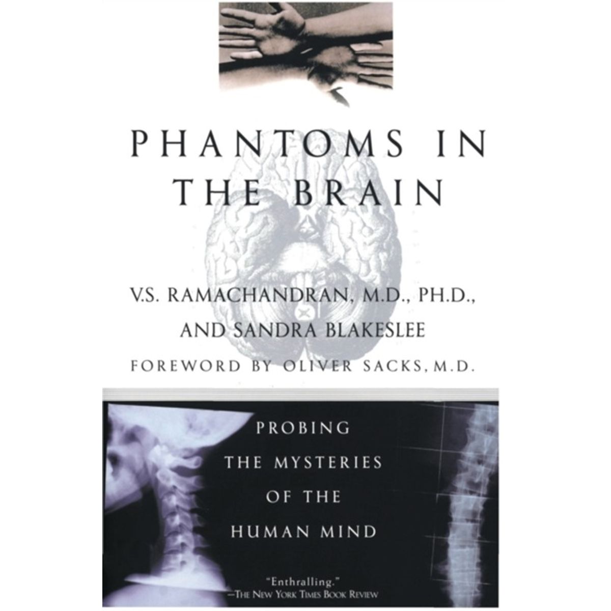 Phantoms in the Brain