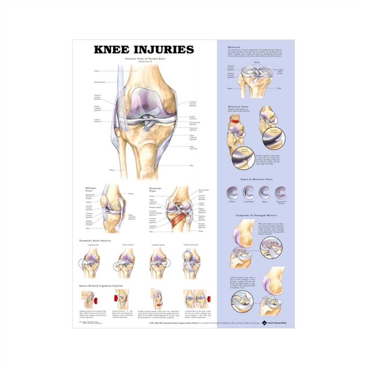 Knæskadeplakat, lamineret anatomisk plakat, 51 x 66 cm